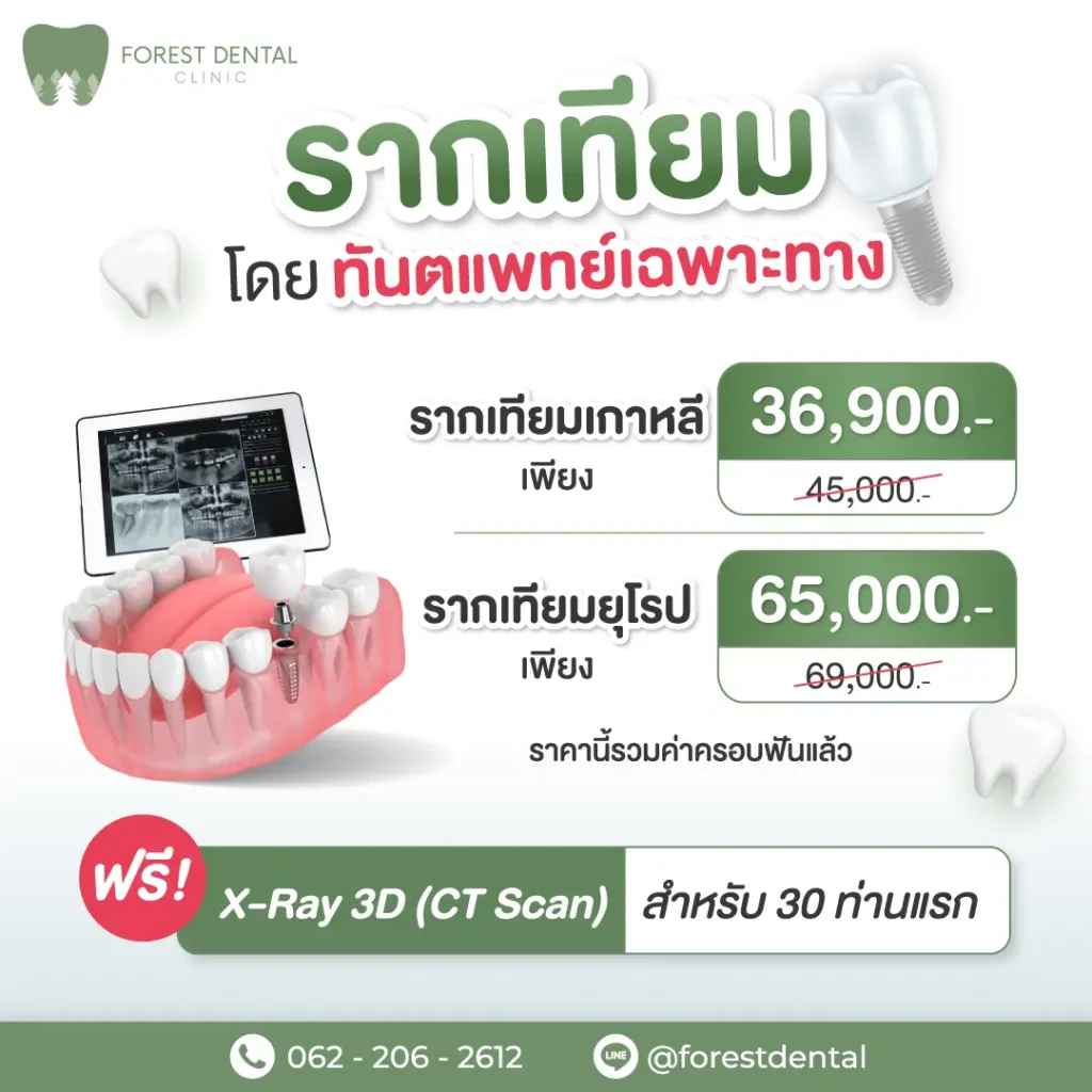 Forest dental รากฟันเทียม OL