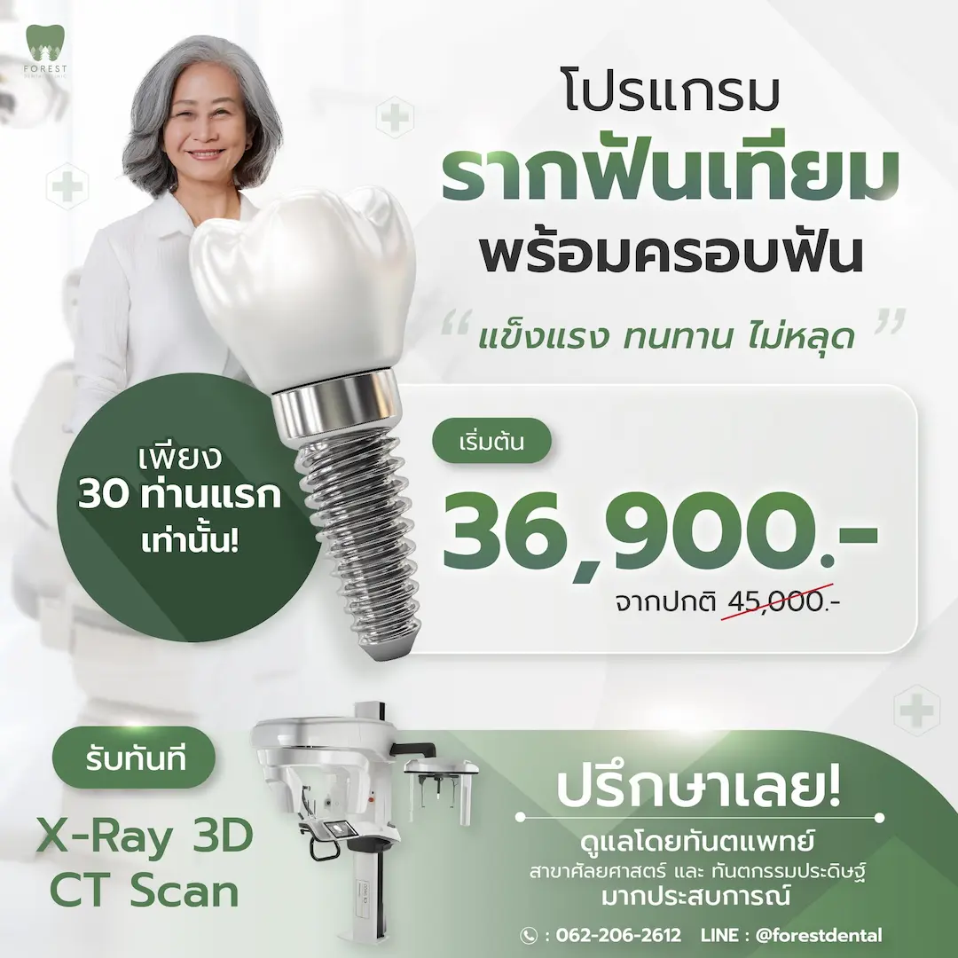 ราคารากฟันเทียมใหม่