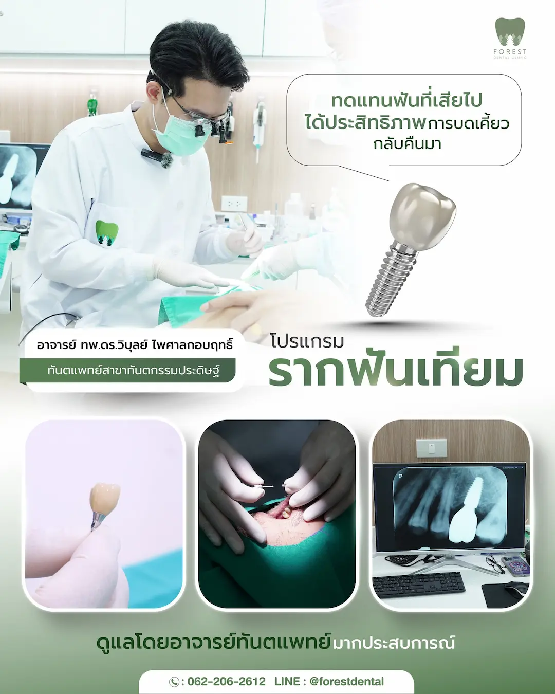 อาจารย์ ทำรากฟันเทียม